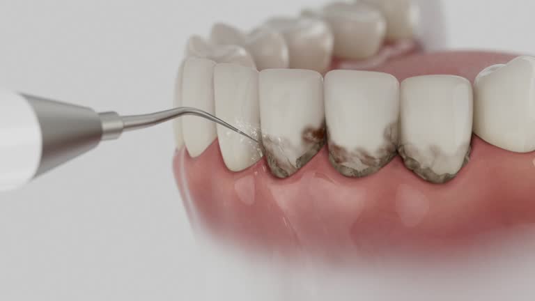 Trusted Teeth Cleaning And Checkup service in Burlington, KS - Dentist Open Now